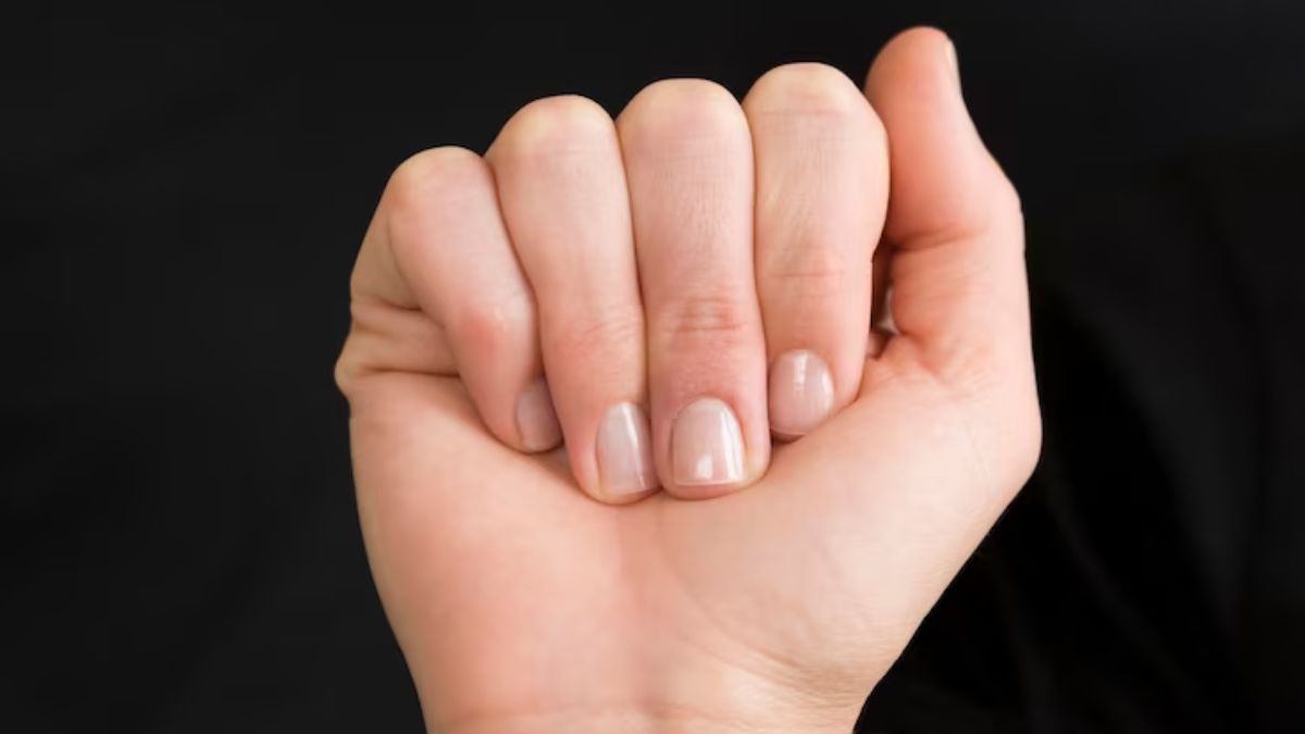 Why do I have white spots on my nails? - Harvard Health