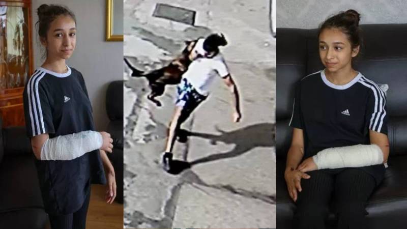 XL Bully Dog Attacked Girl Says Go And Die: