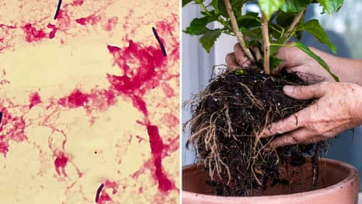 दुनिया की इकलौती महिला, जो 'ब्लैकलेग' से बची; बिल्ली के काटने से फैला था इन्फेक्शन