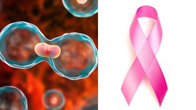 cancer symptoms,cancer types,cancer causes,cancer treatment,5 causes of cancer,cancer disease,breast cancer