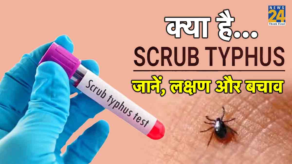 Scrub Typhus Symptoms High Fever Headache