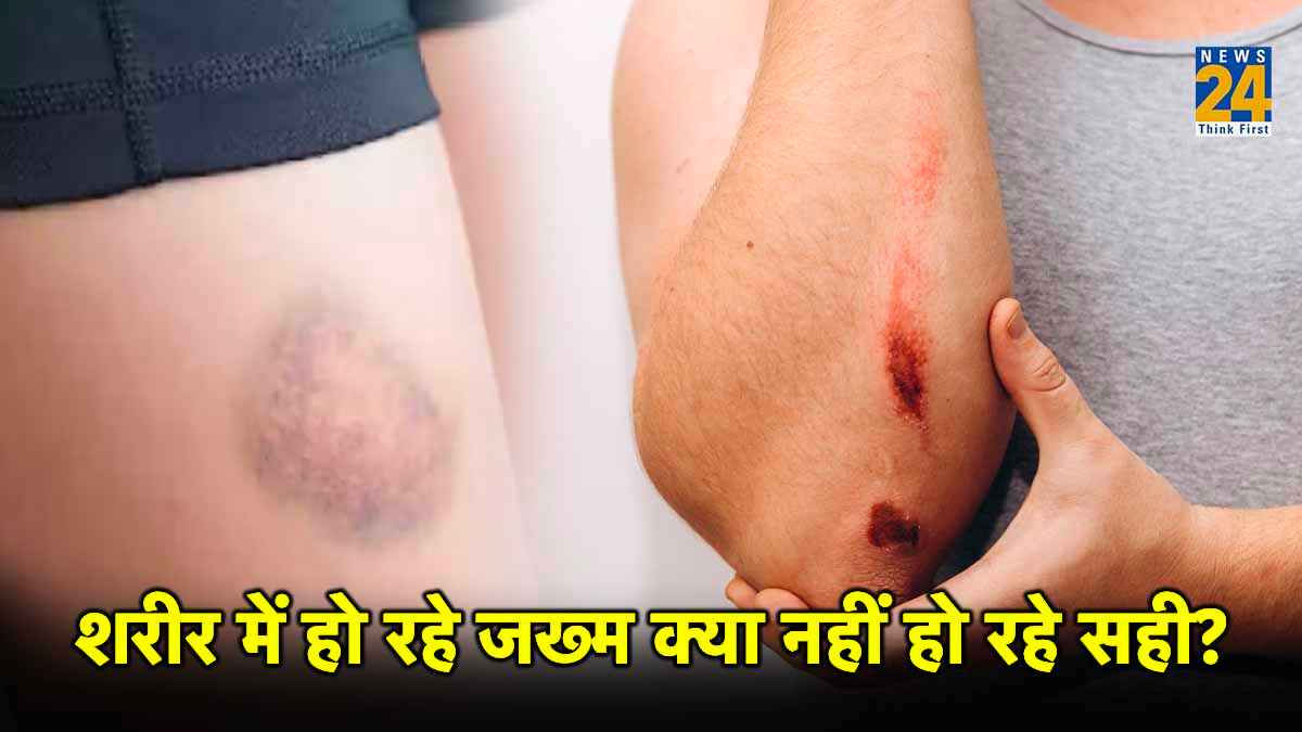 जख्म ठीक होने का नाम नहीं ले रहा तो ये हैं वैरिकोज वेन्स के लक्षण, खतरनाक है बीमारी