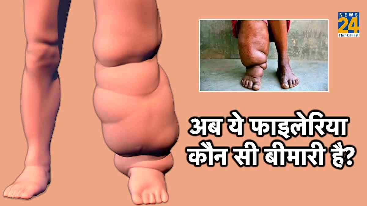 मच्छर के काटने से सिर्फ डेंगू ही नहीं हो सकती है ये जानलेवा बीमारी, हाथ-पैरों पर आ जाती है सूजन