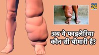 filariasis treatment,filaria is caused by,filariasis symptoms,filariasis skin symptoms,types of filariasis,filariasis is caused by which mosquito,filariasis diagnosis,filariasis cure permanently,