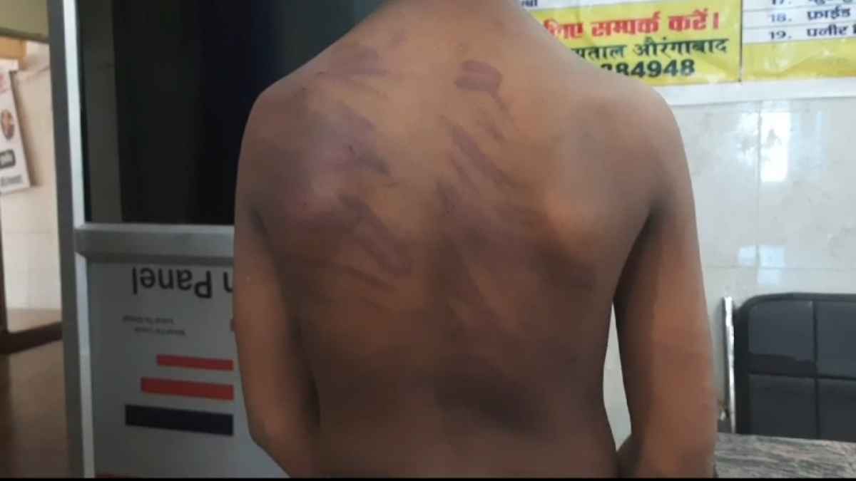 सवाल पूछने पर निजी कोचिंग का टीचर बना हैवान, छात्र को तांबे के तार से बेहोश होने तक पीटा