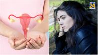 how to cure pcos,pcos treatment,polycystic ovary syndrome symptoms,what are the first signs of pcos?,pcod vs pcos,pcos diagnosis,pcos means,pcos symptoms and treatment,polycystic ovary syndrome symptoms,polycystic ovary syndrome causes,what are the first signs of pcos?,polycystic ovaries,pcos full form