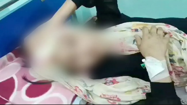 Hospitalised Minor Domestic Maid