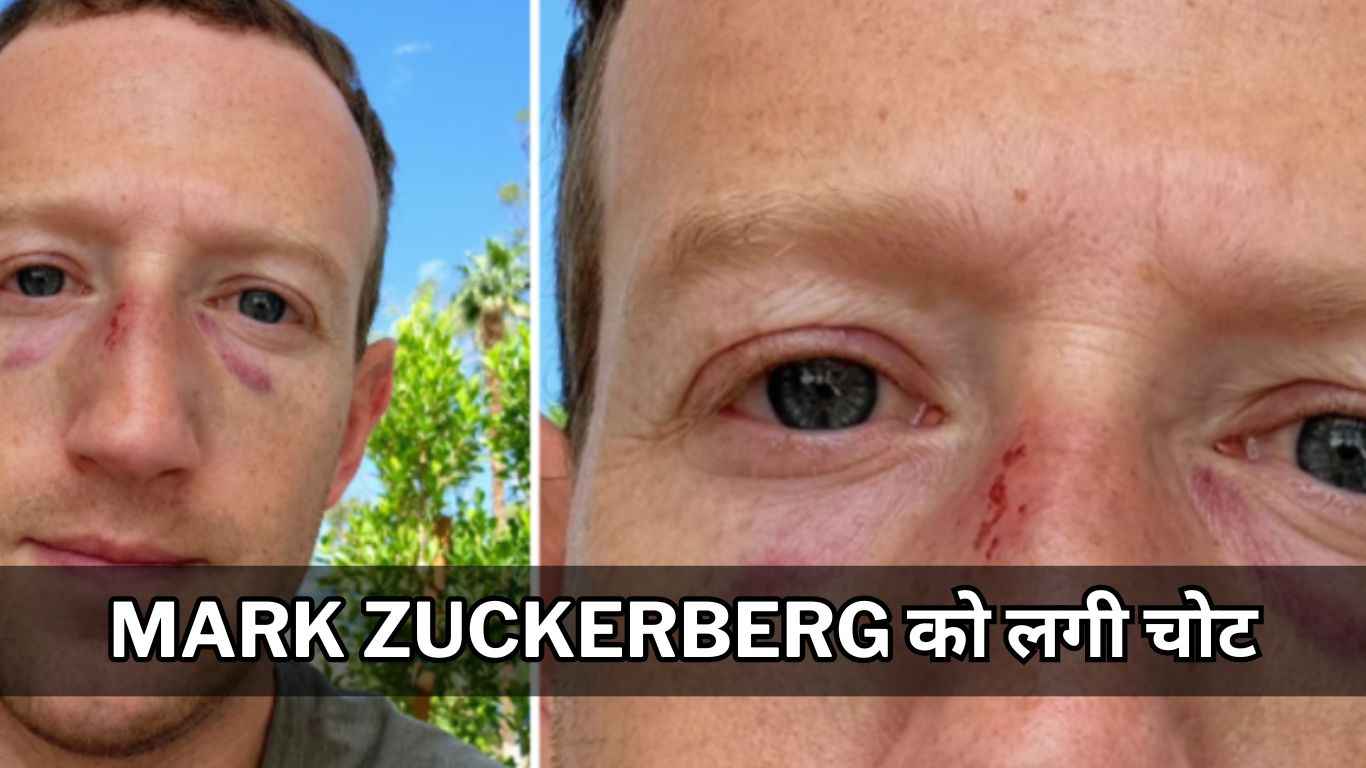 Mark Zuckerberg को लगी चोट, शेयर की फोटो, तो लोगों ने दिए ऐसे रिएक्शन
