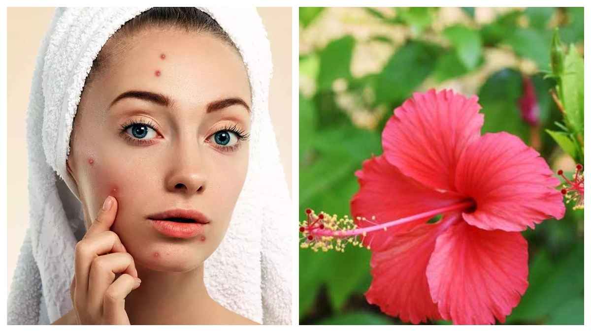 Beauty Tips: गुड़हल के फूलों का इस्तेमाल, नेचुरल ग्लो इनके फेस पैक के साथ