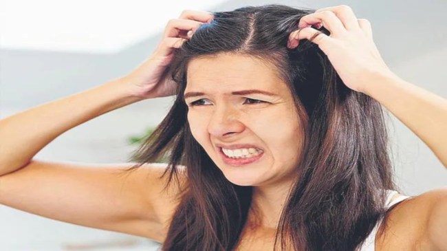 Home Remedies Get Rid Dandruff