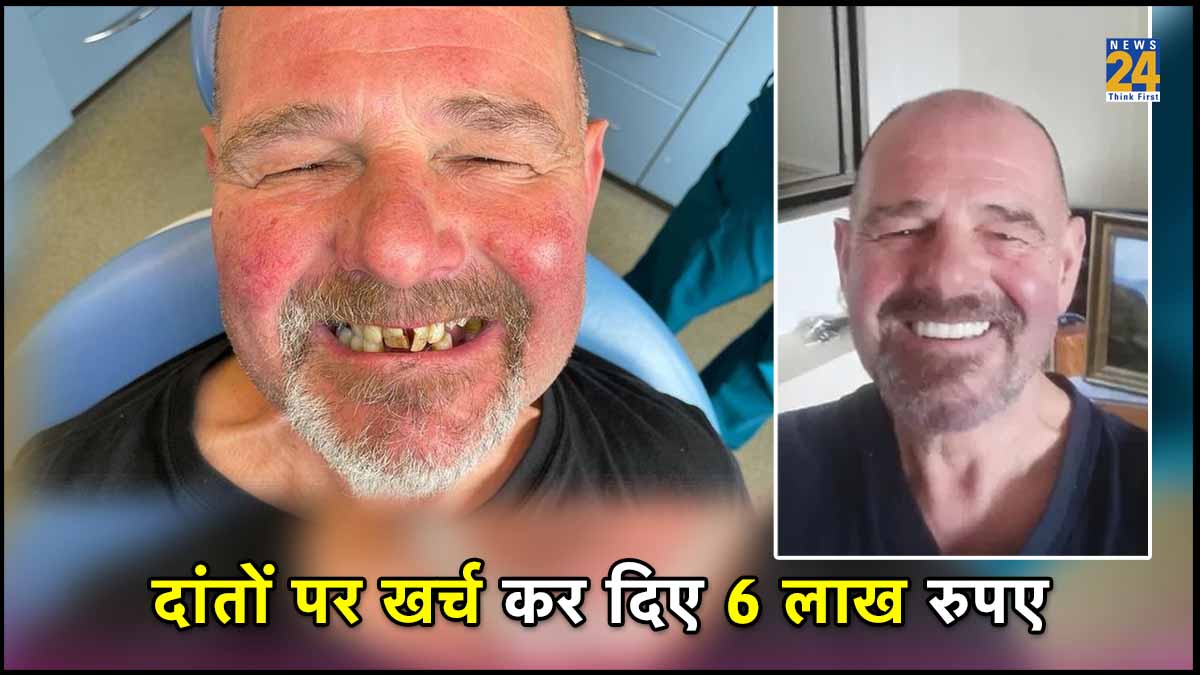 Teeth Problem, Dentist, Ajab Gajab, World News