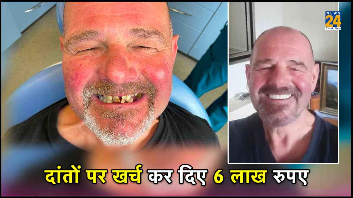 50 सालों तक नहीं मुस्कुराया शख्स, पैरों के नाखून जैसे हो गए थे दांत
