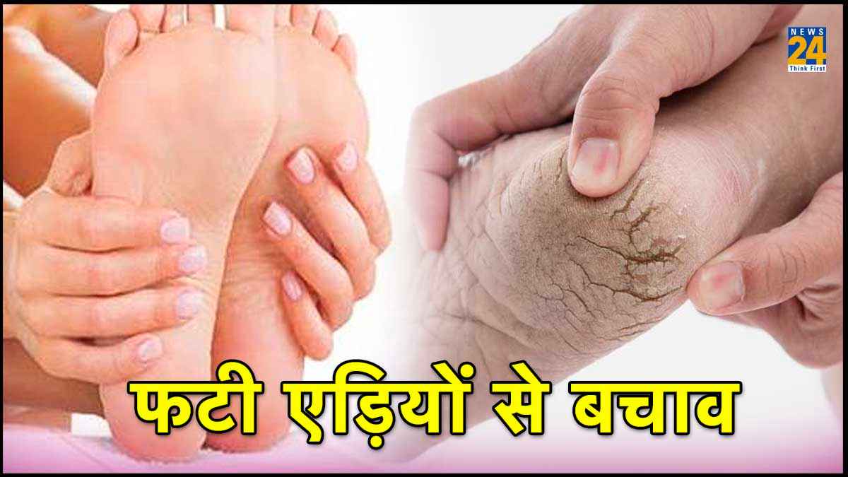 सर्दी में फटी एड़ियों का उपचार, इन 4 घरेलू नुस्खों को अपनाएं और आसानी के साथ आराम पाएं