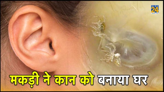 Doctors find spider inside woman's ear Spider, Ear, New England Journal of Medicine, ENT disease