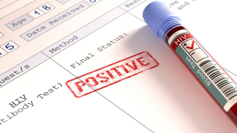 AIDS, HIV Positive, Kanpur News, Health News, UP News