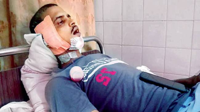 Mumbai Cops Nab Spider Man Thief Mumbai Cops Nab Spider Man Thief Searched More Than 400 Hospitals