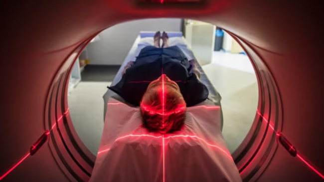 Russian woman has lived 80 years with needle in her brain महिला के ब्रेन में मिली एक इंच से ज्यादा लंबी सुई, 80 साल बाद सीटी स्कैन से हुआ खुलासा