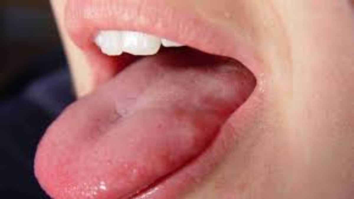 Tongue