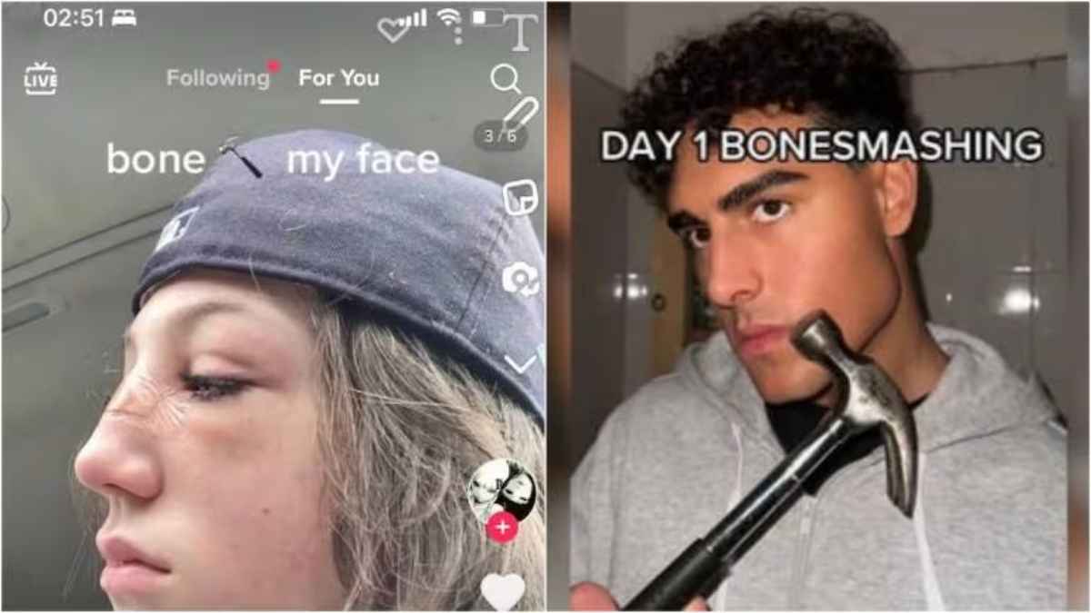 bone smashing ये कैसा ट्रेंड! टिकटॉक पर लोग हथौड़ी से तोड़ रहे अपने चेहरे की हड्डियां, एक यूजर ने आजमाया तो बिगड़ गया फेस