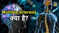 multiple sclerosis,multiple sclerosis cause,multiple sclerosis diagnosis,multiple sclerosis life expectancy,what causes multiple sclerosis in females,multiple sclerosis symptoms in females,multiple sclerosis pathophysiology,multiple sclerosis medication,multiple sclerosis symptoms in females,multiple sclerosis diagnosis,multiple sclerosis life expectancy