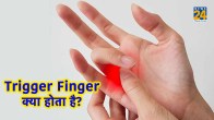 trigger finger exercises,how to unlock trigger finger,trigger finger causes,what causes trigger finger in the ring finger,trigger finger medication,finger stiffness and locking,trigger finger surgery,what causes trigger finger in the middle finger