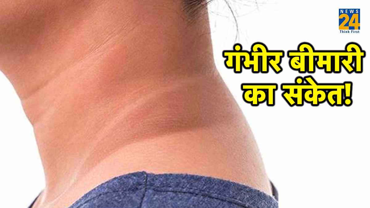 नजरअंदाज न करें गर्दन का कालापन! बन सकता है 4 बीमारियों का कारण