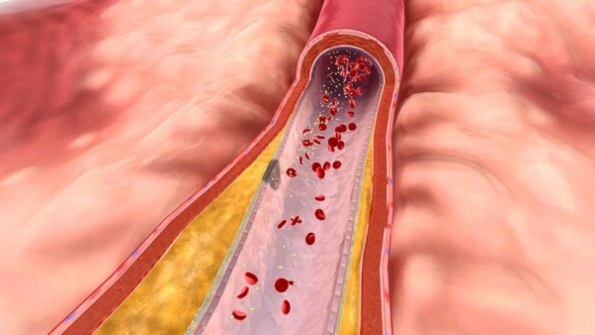 how to reduce cholesterol in 7 days how to reduce cholesterol in 30 days 40 foods to lower cholesterol egg cholesterol ldl or hdl foods to avoid with high cholesterol how to reduce ldl cholesterol what reduces cholesterol quickly naturally 15 foods that lower cholesterol