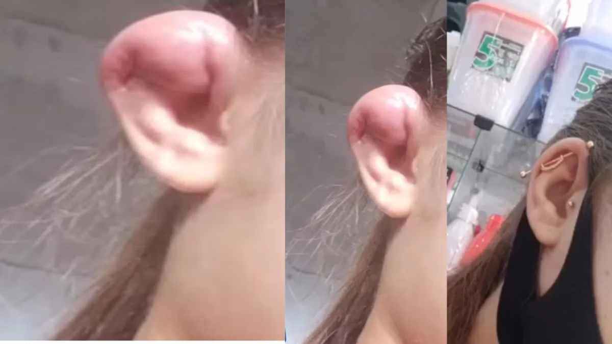 Ear Cut
