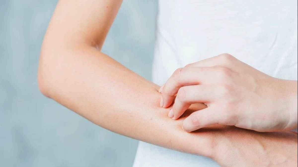 रूखी त्वचा की समस्या से आप भी हैं परेशान तो अपनाएं 5 टिप्स
