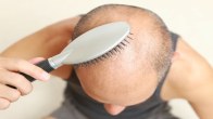 hair fall, baldness treatment, hair fall reducing, effective solution, hair fall treatment effective solution