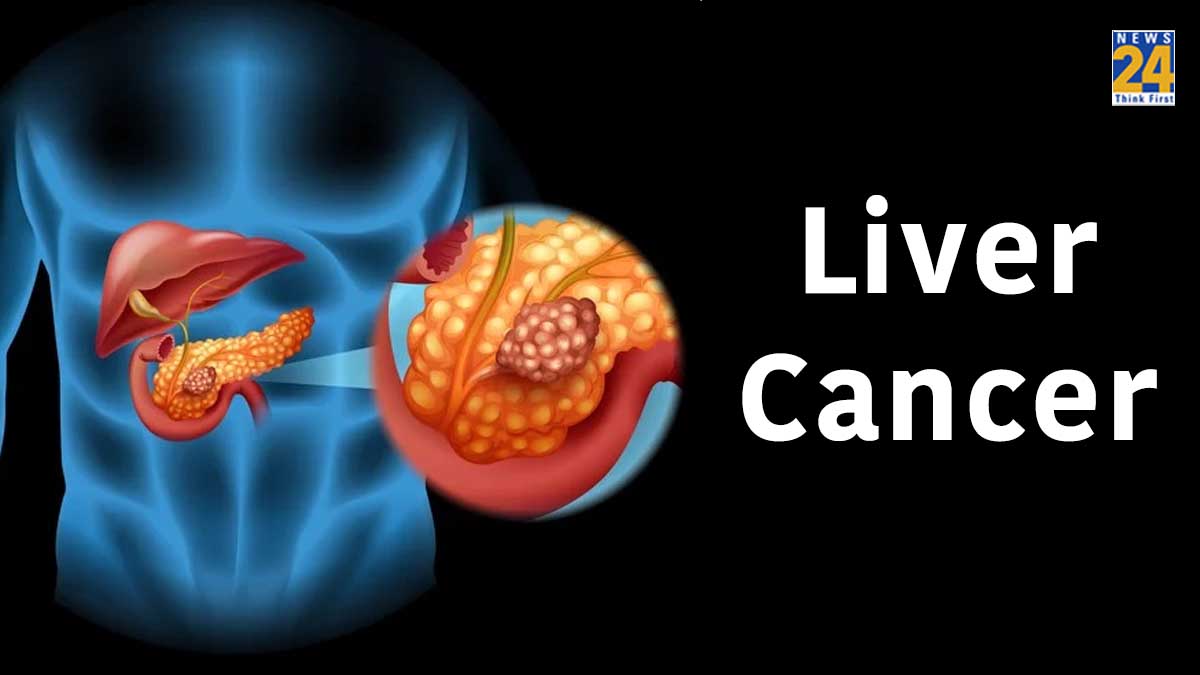what is the first sign of liver cancer liver cancer causes stage 3 liver cancer symptoms liver cancer symptoms female liver cancer survival rate secondary liver cancer why is liver cancer so deadly liver cancer stages