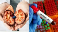 when to worry about creatinine levels normal creatinine levels by age is creatinine level 1.7 dangerous what level of creatinine indicates kidney failure? creatinine normal range creatinine level low is 2.9 creatinine level dangerous creatinine levels chart