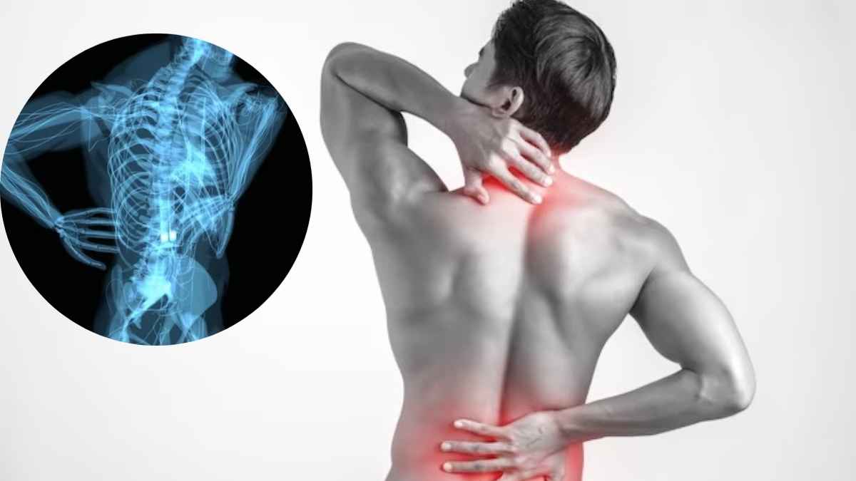 40 की उम्र में हड्डियां ना हो जाएं कमजोर, अपनाएं 5 घरेलू नुस्खे