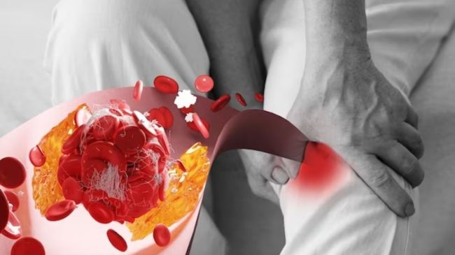 blood clot is blood thicker in winter or summer do blood thinners cause cold hands and feet why does blood thicken in cold weather why do blood thinners make you cold why do blood vessels constrict when cold does cold weather affect blood circulation blood thinners and heat tolerance does temperature affect blood thickness