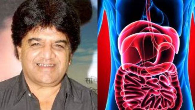 Junior Mehmood Death, Junior Mehmood, Junior Mehmood Death Reason, Bollywood, Entertainment,Junior Mehmood Death, Junior Mehmood, Junior Mehmood Death Reason, Bollywood, Entertainmentstage 4 stomach cancer symptoms stage 1 stomach cancer symptoms female how i knew i had stomach cancer stomach cancer causes stomach cancer symptoms male stages of stomach cancer symptoms stomach cancer survival rate