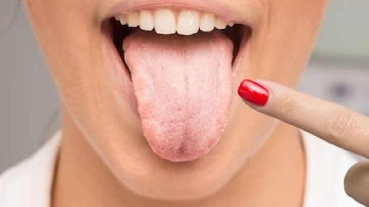 unhealthy tongue pictures healthy tongue pictures vs unhealthy tongue health chart what does your tongue say about your health chinese medicine how to read your tongue scalloped tongue normal tongue pictures normal under tongue pictures