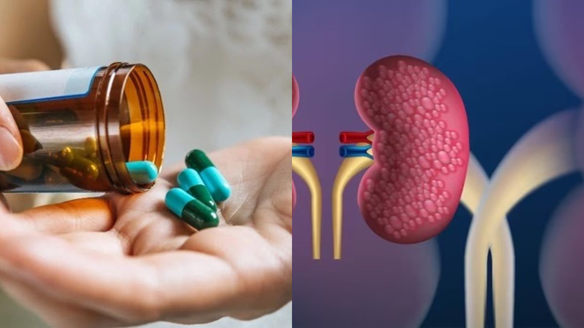 chronic kidney disease stages chronic kidney disease causes what is the latest treatment for chronic kidney disease? chronic kidney disease stage 5 chronic kidney disease stage 3 what are the first signs of kidney disease types of kidney disease chronic kidney disease pathophysiology