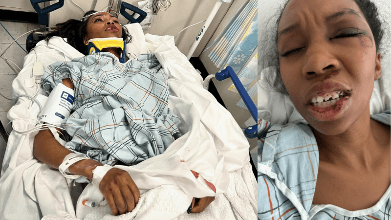 Marvel Actress Carrie Bernans Accident