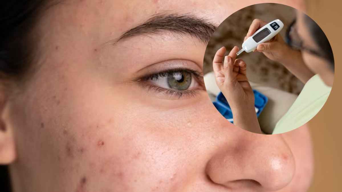 Diabetes Symptoms