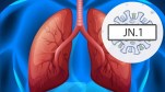 JN 1 AND LUNGS PROBLEMS