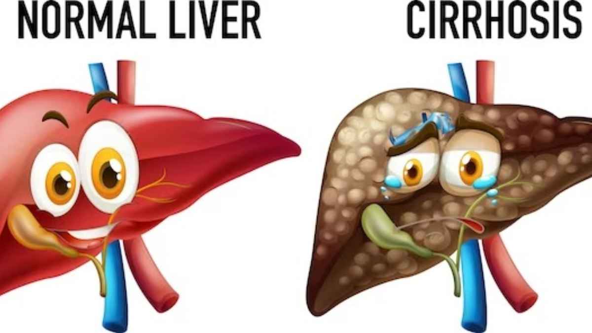 थकान और कमजोरी आम नहीं, Liver की गंभीर बीमारी की ओर करता है इशारा!