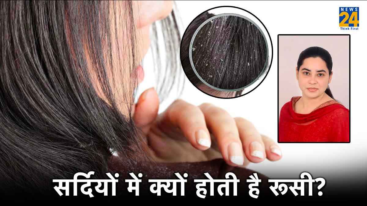Dandruff in Winter: क्या डैंड्रफ सिर्फ एक मौसमी समस्या है? एक्सपर्ट से जानें कारण और बचाव