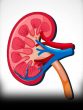kidney stone causes