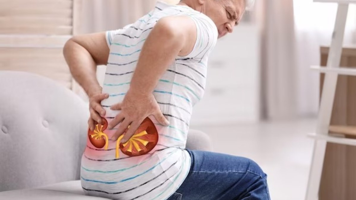 kidney stones symptoms