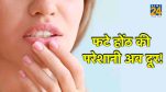 Chapped lips in winters will become soft in minutes