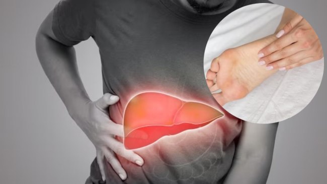 liver problems symptoms