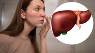 liver symptoms on face