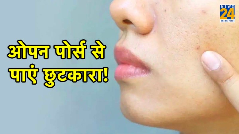 How to get rid of open pores Skin Care Tips