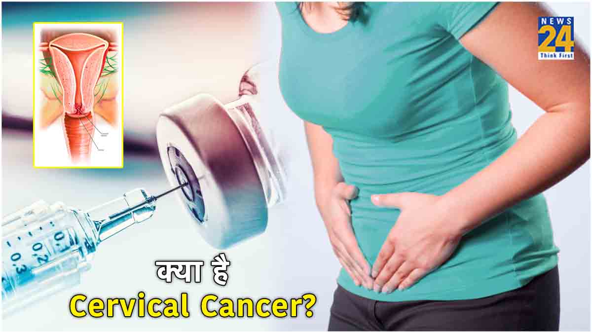 Cervical Cancer