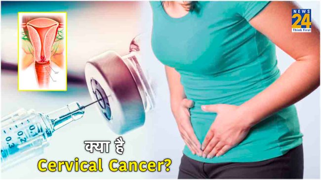 Cervical Cancer